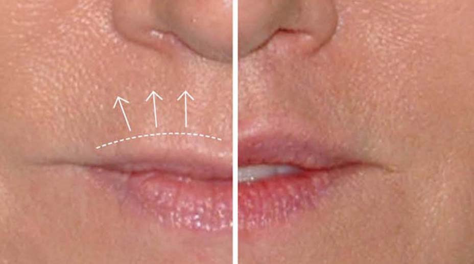 lips publicity embed 2019 compressed