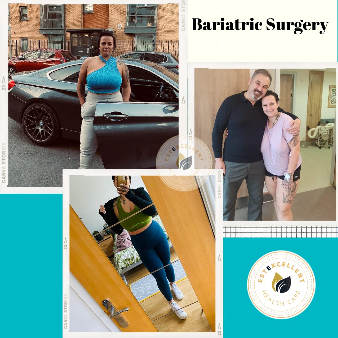 Bariatric Surgery and Waiting List in the UK